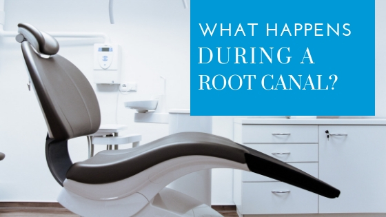 during a root canal